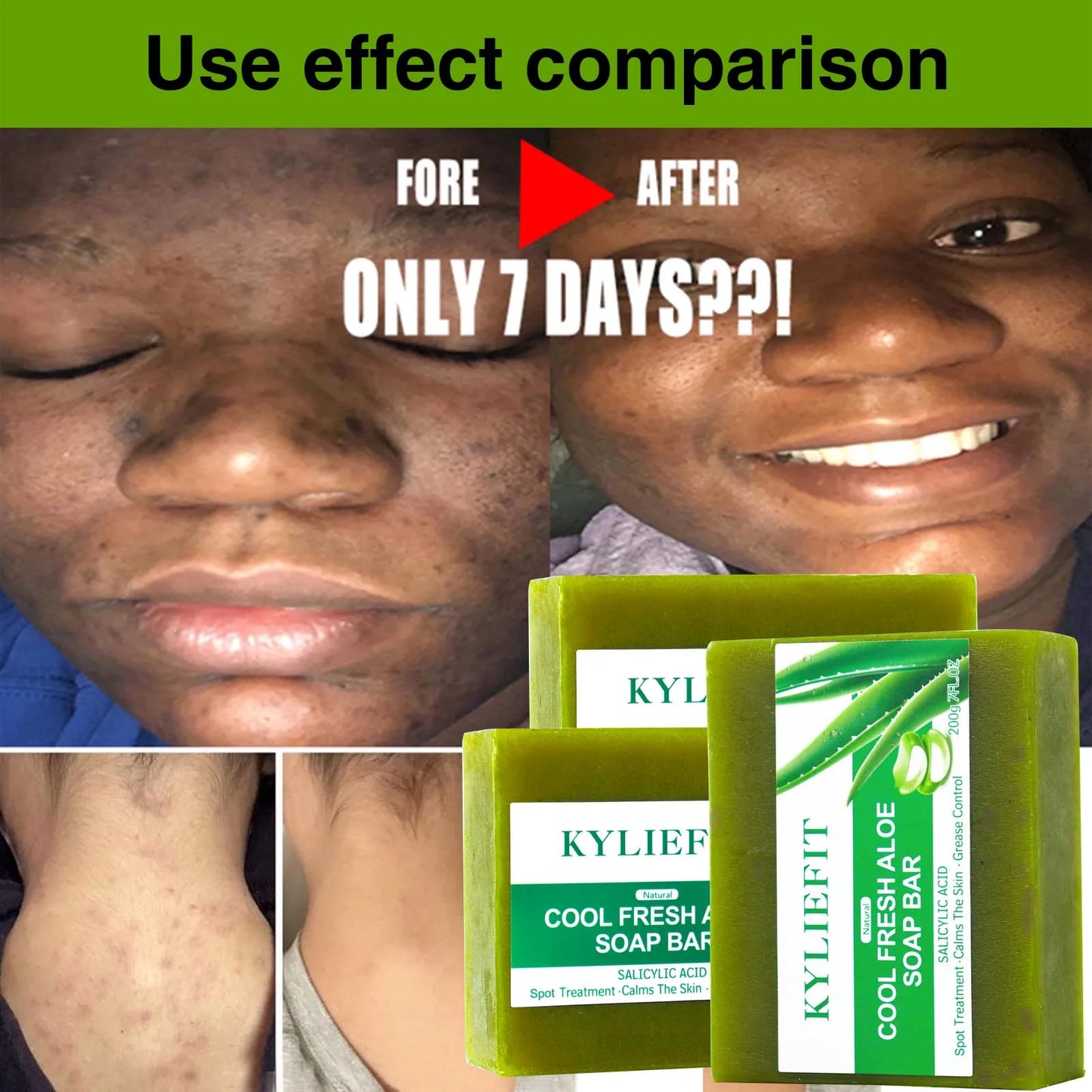 AILKE Aloe Brightening Soap Bar For Face And Body Daily
